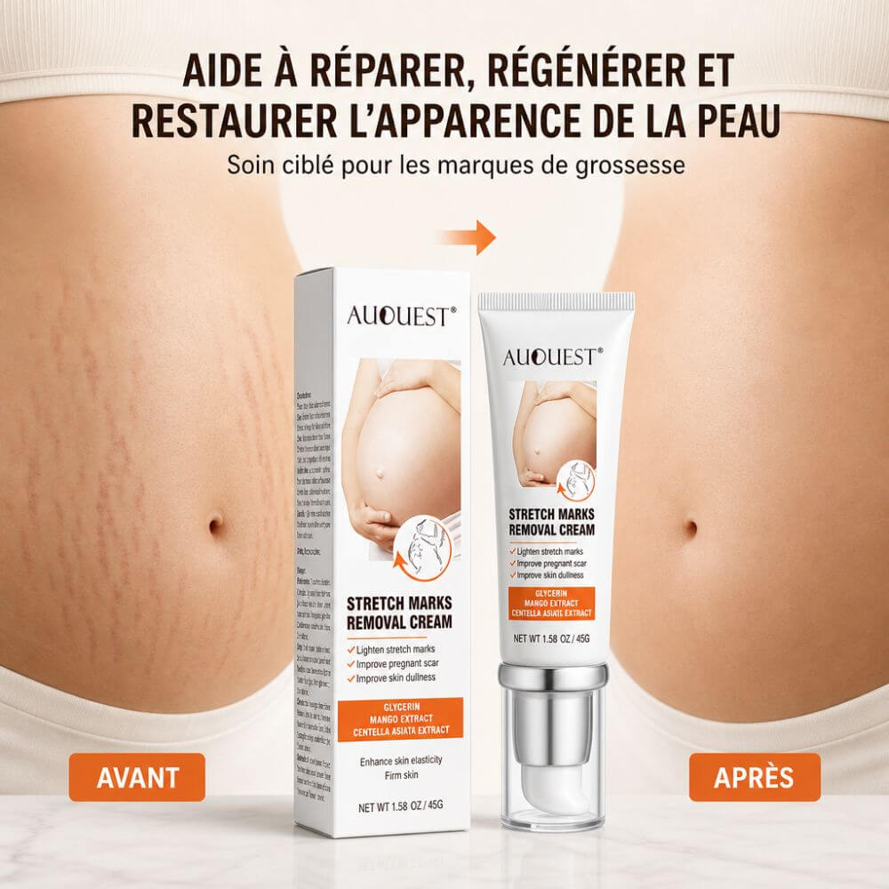 Crème réparatrice cicatrices vergetures
