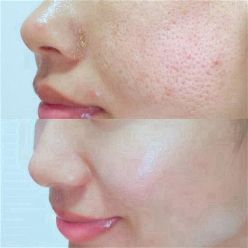 Pore Refining Serum