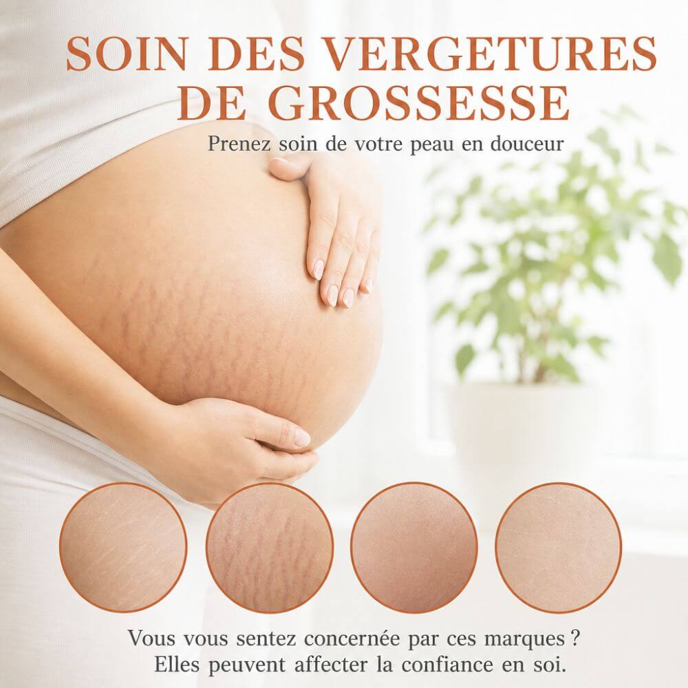 Crème réparatrice cicatrices vergetures