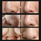 Blackhead Shrinking Combination Kit