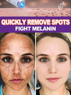 Color: Pink - H? s? ???? ? s? ?? ??? s???, ?