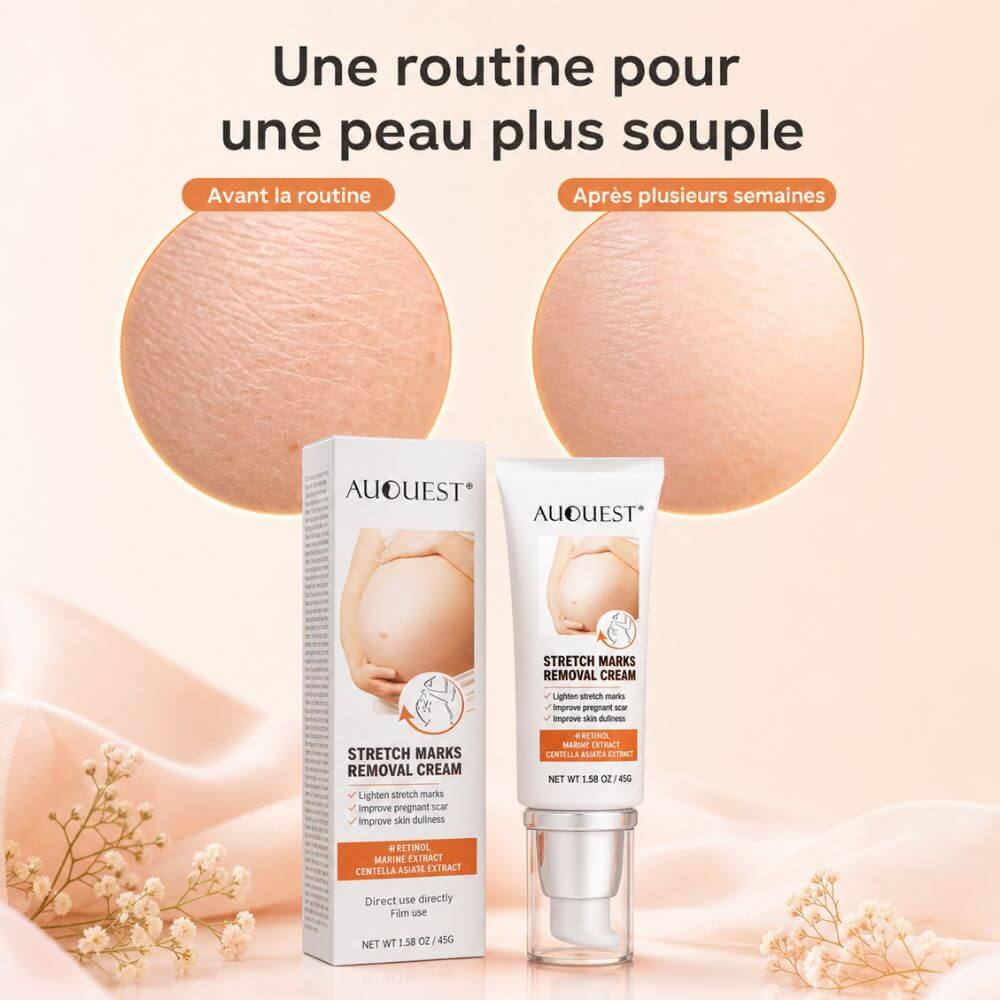 Crème réparatrice cicatrices vergetures